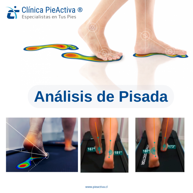 Analisis de Pisada